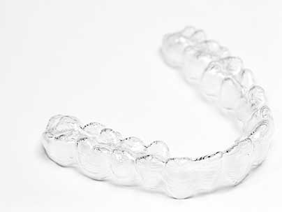 invisalign braces